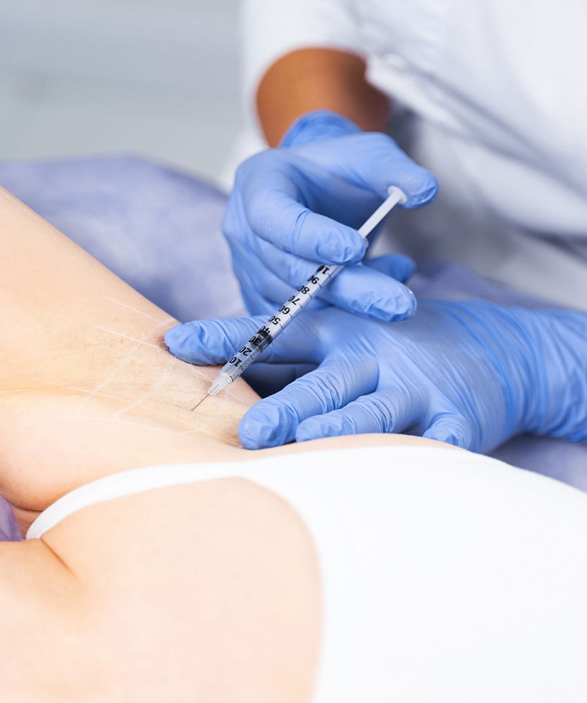 Image for Hyperhydrosis