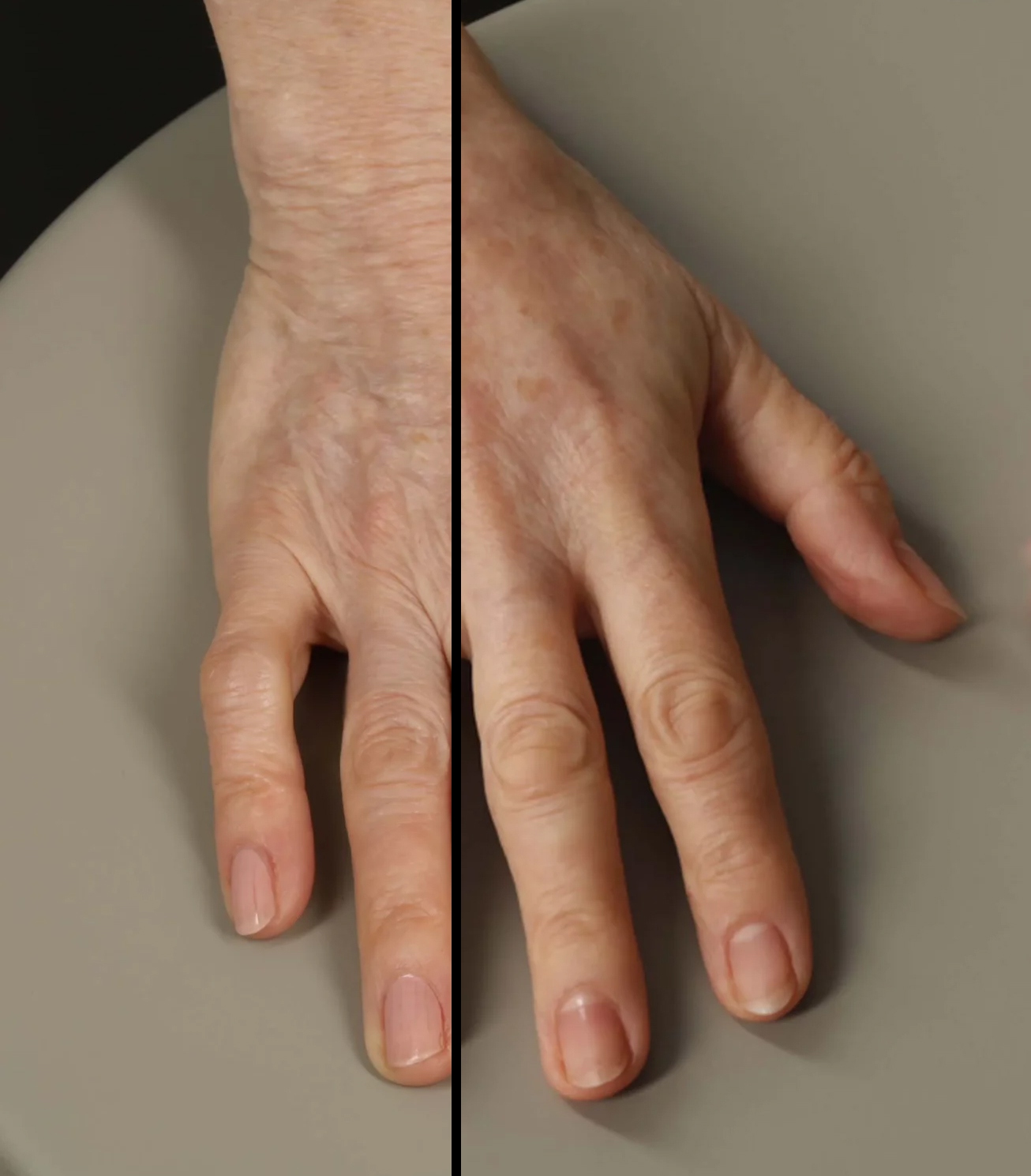 Image for Hand fillers