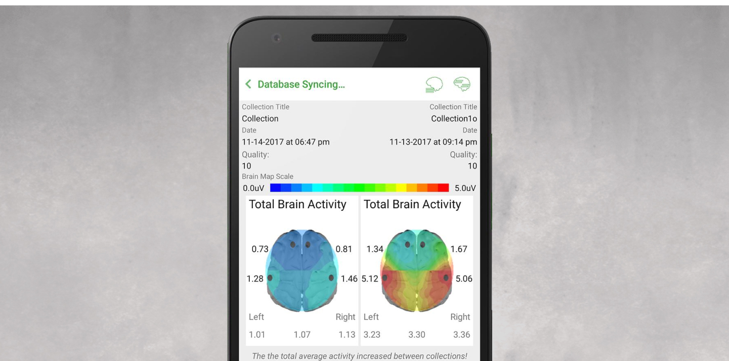 NeuroTek Device