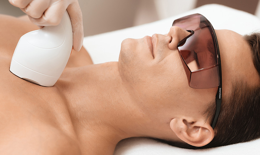 Laser Hair Removal for Men