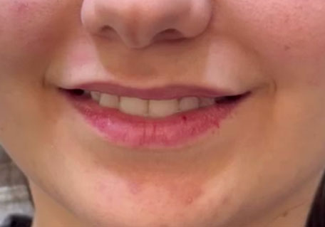 Before