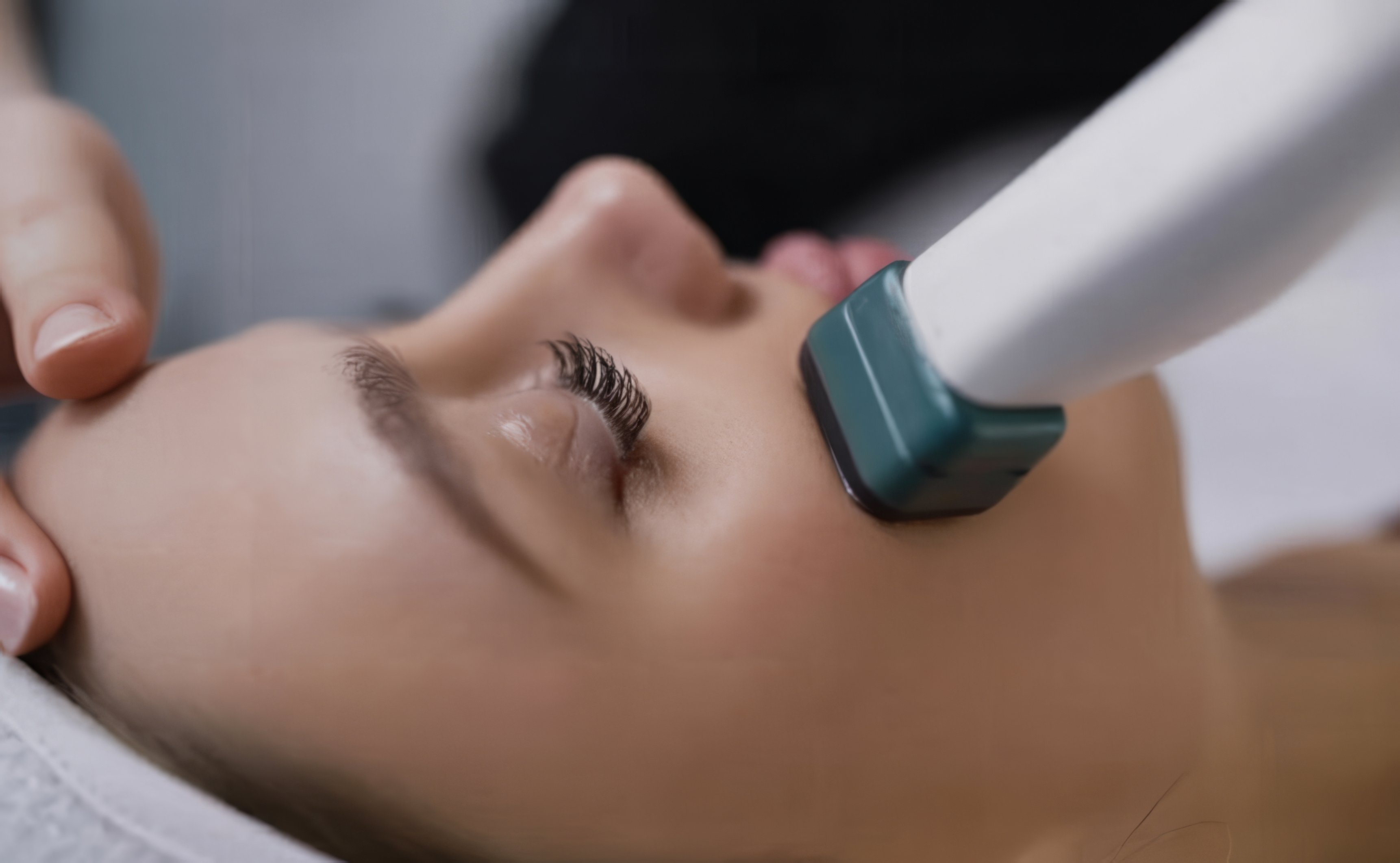 What to Expect During Your XERF Treatment in Toronto