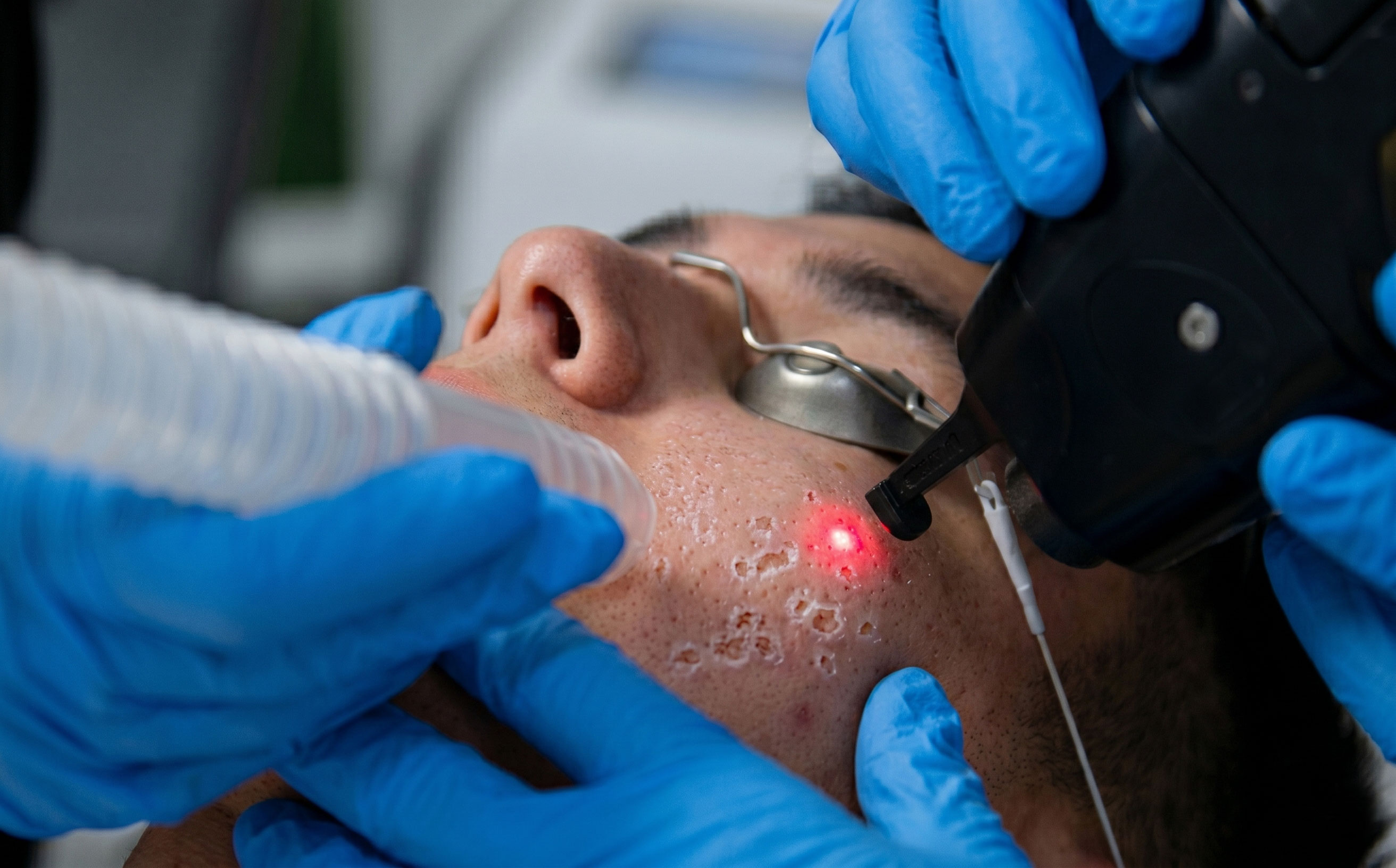 What If You Could Reset Your Skin?