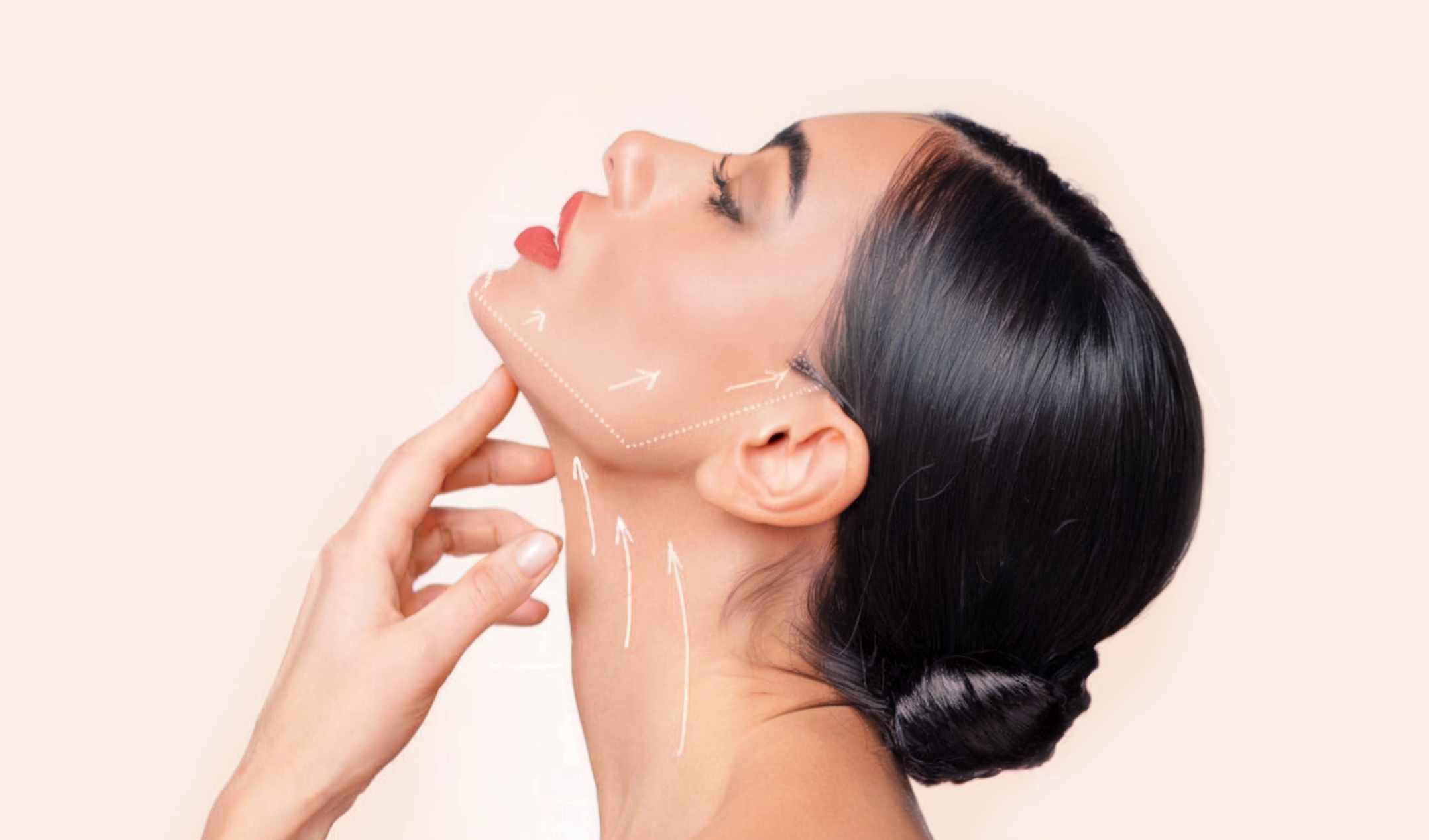Revitalize Your Skin with Hyperdiluted Radiesse in Toronto
