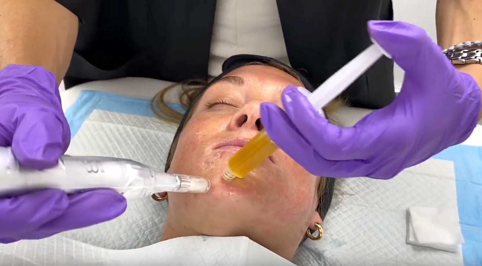 Transform Your Beauty Naturally with Cellenis® NaturaGel PRP