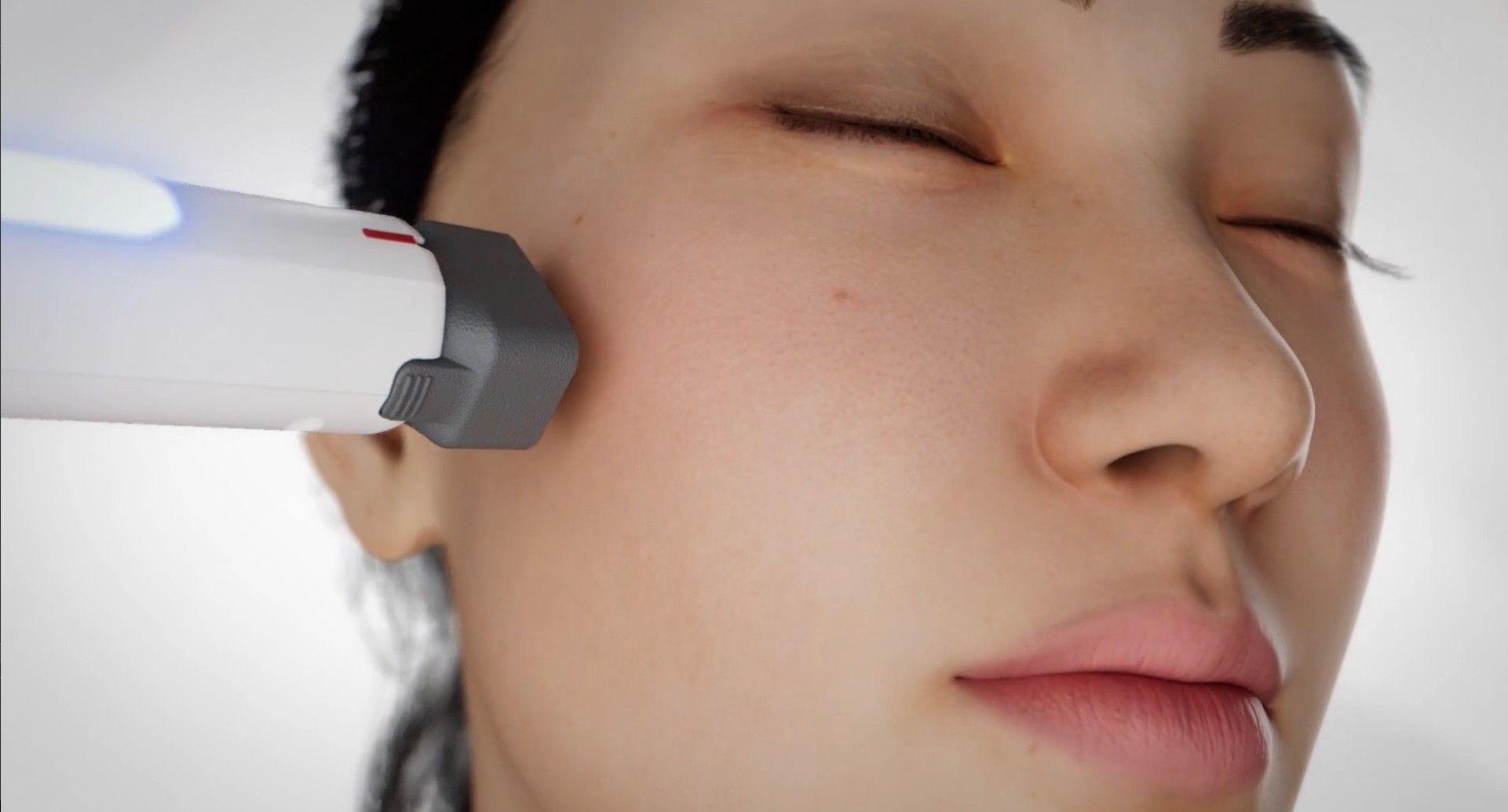 XERF Skin Tightening: Perfect Fall Treatment for Women and Men