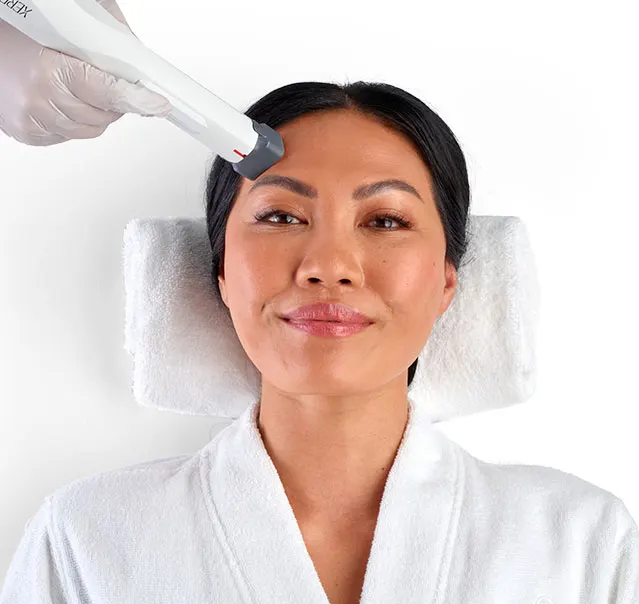 XERF Skin Tightening in Toronto
